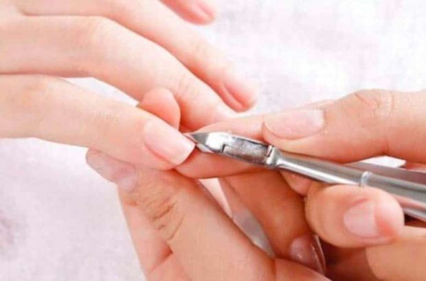 mẫu móng để xét nghiệm