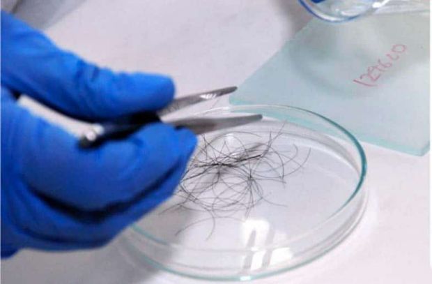 mẫu tóc để xét nghiệm ADN